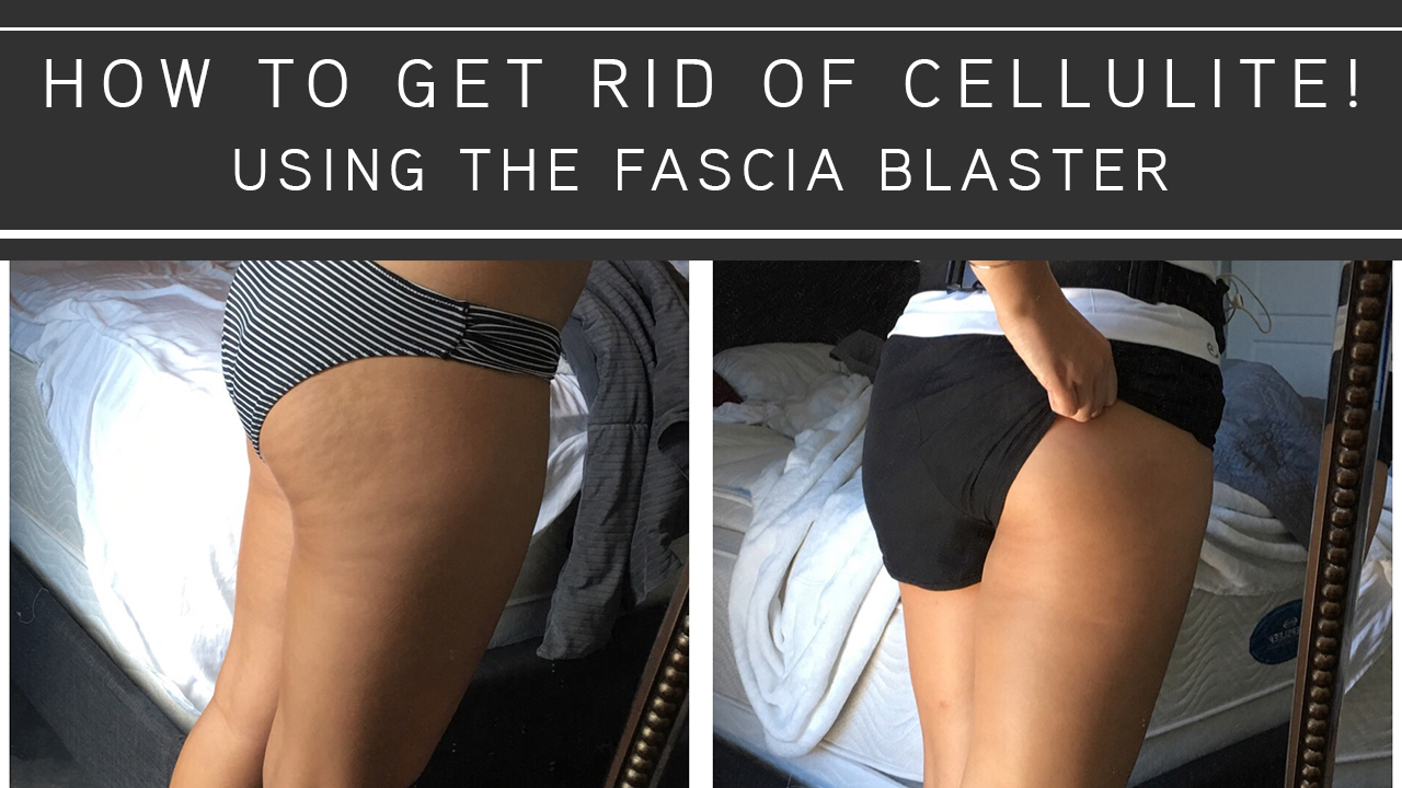 How To Get Rid Of Cellulite Using The Fascia Blaster - KARLIECOLLEEN.COM